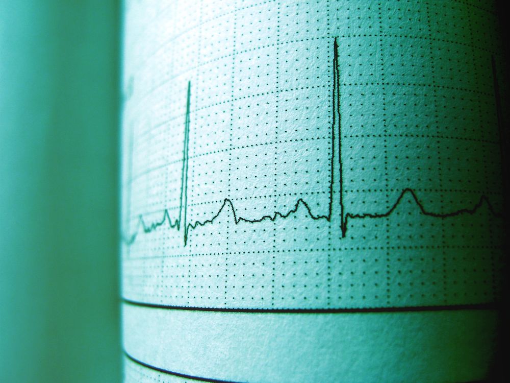 Trazo de electrocardiograma mostrando el patrón del latido cardíaco
