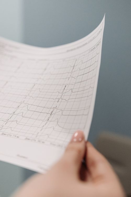 Paciente revisando los resultados de un electrocardiograma con un profesional médico.