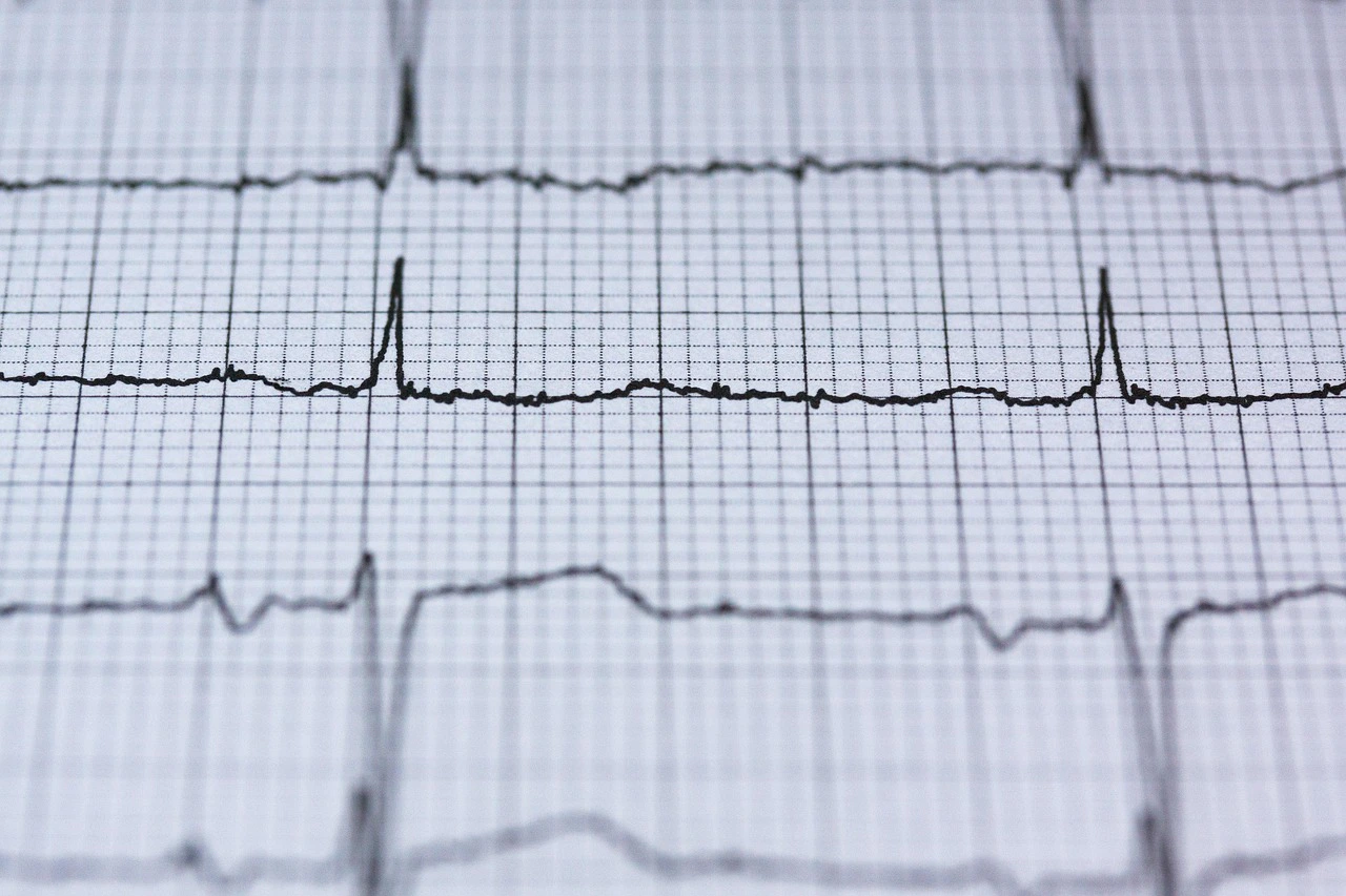 Pantalla de monitor cardíaco mostrando el trazado verde de un electrocardiograma